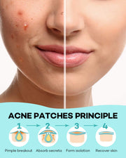 ClearSkin Hydrocolloid Acne Patches 🌟🩹